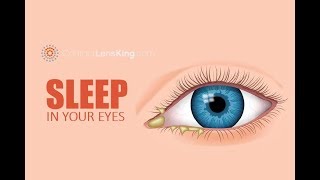 Eye Discharge Eye Boogers Rheum Sleep in Your Eyes What is it What Causes It [upl. by Murage]