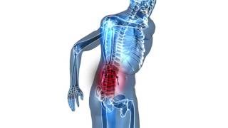 Back Pain Linked to Knee Pain [upl. by Auhsohey319]