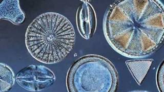 Beautiful Diatoms [upl. by Lered]