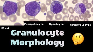 The different morphologies of Granulocytes neutrophils eosinophils and basophils [upl. by Calvert]