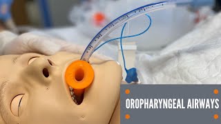 Oropharyngeal Airway Insertion [upl. by Morganne180]