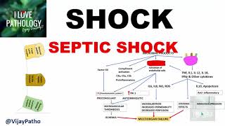 SHOCK Types Pathogenesis of Septic Shock [upl. by Sherill320]