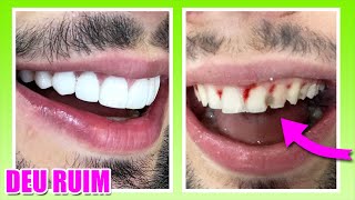 OS MEUS DENTES CAIRAM [upl. by Magdalena830]