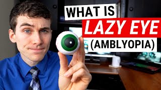 What is LAZY EYE Amblyopia and What Causes It [upl. by Badger]