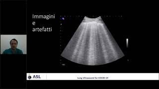 Ecografia polmonare per le USCA 3  Segni di base [upl. by Ainud]