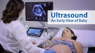 ULTRASOUND An Early View of Baby [upl. by Meras]