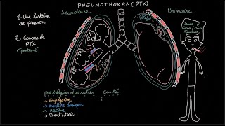 Pneumothorax  Docteur Synapse [upl. by Lionello]