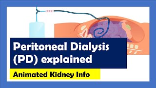 Peritoneal Dialysis explained [upl. by Renae]