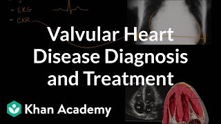 Valvular heart disease diagnosis and treatment  NCLEXRN  Khan Academy [upl. by Hu577]