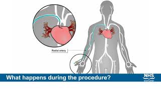 Coronary Angiography Albert Raizner MD [upl. by Freed]