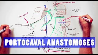 Portocaval Anastomoses  ANATOMY Tutorial [upl. by Ram]