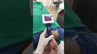 Video Laryngoscopy intubation for an Adult Patient [upl. by Merv]