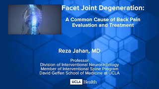 Facet Joint Degeneration A Common Cause of Back Pain Evaluation and Treatment [upl. by Tamah]