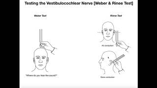 Interpreting the WeberRinne Tests EXPLAINED [upl. by Kirrad739]