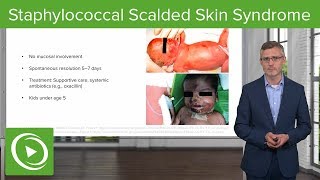 Staphylococcal Scalded Skin Syndrome – Dermatology  Lecturio [upl. by Areis]