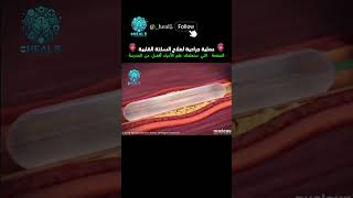 Coronary Arteries  in 2mins [upl. by Haelahk]