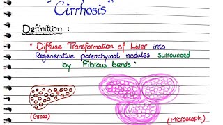 Cirrhosis of Liver  Pathology [upl. by Vedetta]