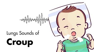 Sounds of Croup Laryngotracheitis  Lung Sounds  MEDZCOOL [upl. by Amadas856]