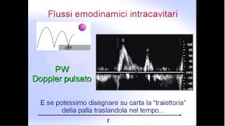 Aritmie Ventricolari  Cardioverter e Ablazione Transcatetere [upl. by Ahsaetan887]