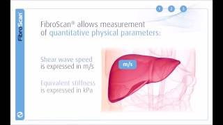 3 Stages of the FibroScan examination [upl. by Earas]