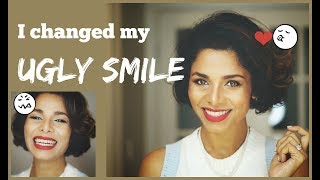 How to IMPROVE AWKWARD SMILE into PICTURE PERFECT Smile Without Dentist GIVEAWAY [upl. by Trinee]