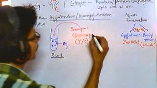 Antibody test qualitative [upl. by Hgeilhsa221]