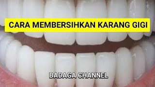 Cara Membersihkan Plak Gigi Atau Karang Gigi Dengan Baking Soda Dan Pasta Gigi [upl. by Eibba]