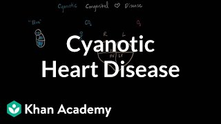 What is cyanotic heart disease  Circulatory System and Disease  NCLEXRN  Khan Academy [upl. by Dickenson]