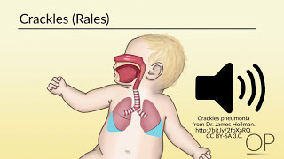 Respiratory Assessment by B Leary L DelSignore  OPENPediatrics [upl. by Schroth]