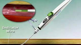 Pericarditis  Nursing Management Treatment of Pericardial Effusion Friction Rub amp Pericardium [upl. by Assirialc]