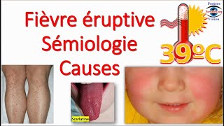 Fièvre éruptive Sémiologie Éruption erythemato maculo papuleuse vésiculeuse purpura Toxidermie [upl. by Gurl702]