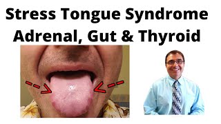 Stress Tongue Syndrome Adrenal Gut amp Thyroid [upl. by Mixam538]