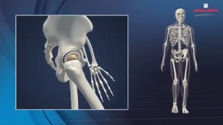 DUAL MOBILITY Concept amp Surgical Technique 3D Animation [upl. by Ericksen35]