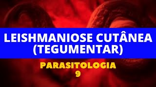 LEISHMANIOSE CUTÂNEA TEGUMENTAR  PARASITOLOGIA 9 [upl. by Ybba703]