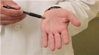 Dermatology Treatments  How to Cure Sweaty Palms [upl. by Levin]