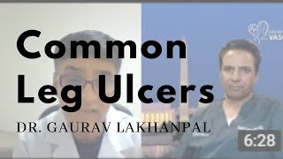 Pressure Ulcers  Symptoms Causes amp Treatment  Wound Care Surgeons [upl. by Amekahs]