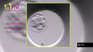 TimeLapse  Embryo development ENG first 100 hours [upl. by Bauske]