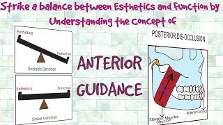 Anterior Guidance  Understanding the Concept [upl. by Aimerej489]