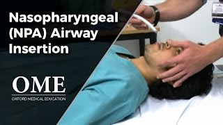 Nasopharyngeal Airway Insertion [upl. by Nichols]