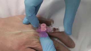 Cannulation How to gain IV access [upl. by Zulaledairam]