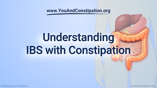 Understanding IBS with Constipation [upl. by Ear871]