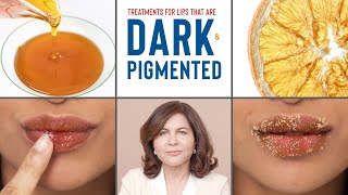 How To Treat DARK PIGMENTED Lips  Dermatologists Advice [upl. by Meyer883]