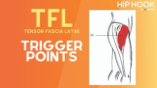 TFL Trigger Point Release  How to Release the Tensor Fascia Latae Muscle [upl. by Mariko311]