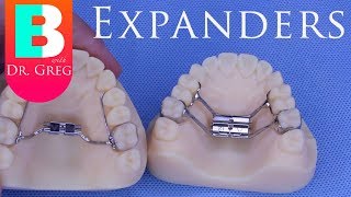 BRACES EXPLAINED Palatal Expanders [upl. by Noedig]