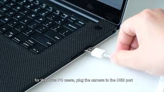 How to use Anykit NTE430 USB Ear Wax Camera with Windows PC [upl. by Rednasxela]