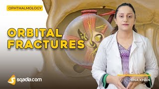 Orbital Fractures  Miscellaneous Conditions  Ophthalmology Lectures  VLearning [upl. by Adnahsar]