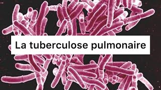 📍 Comprendre La Tuberculose pulmonaire en 30 min  🔥 khadidja ferdj [upl. by Jelene]