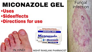 Miconazole nitrate cream  Uses sideeffects directions  Fungal infection treatment in Hindi [upl. by Ludly]