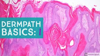 Basic Dermpath Cases  Explained by a Dermatopathologist [upl. by Assirek445]