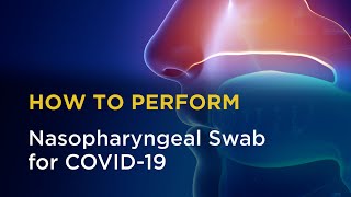 Nasopharyngeal Swab for COVID19 [upl. by Llehcal]